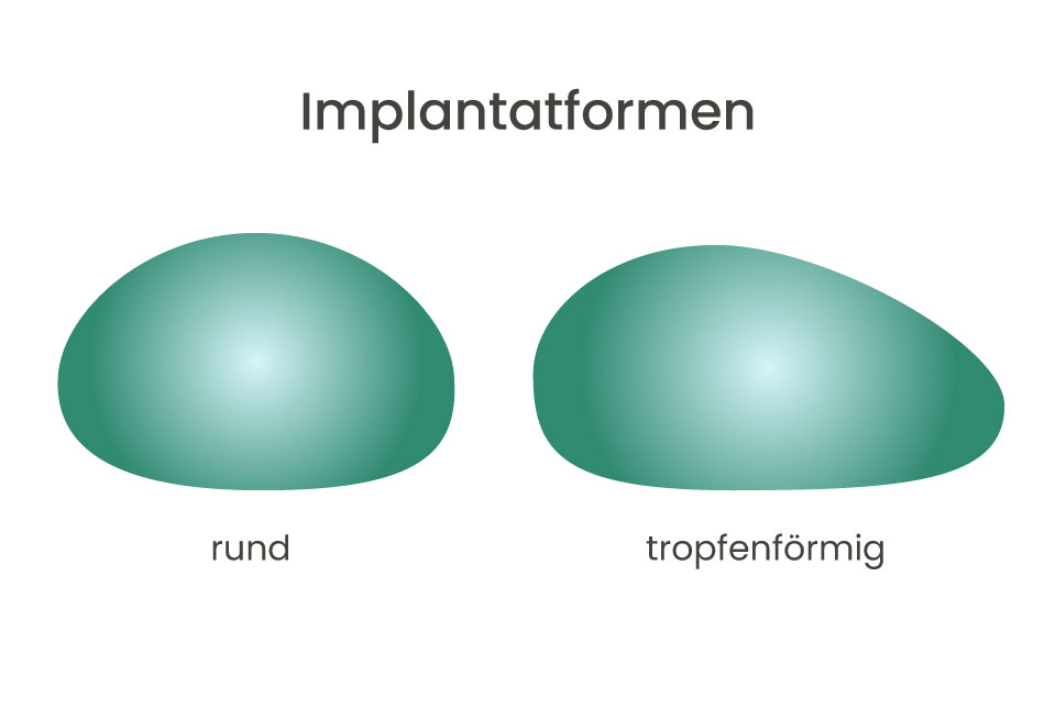 Brustvergrößerung Nürnberg Implantatformen