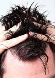 AC Therapie gegen Haarausfall